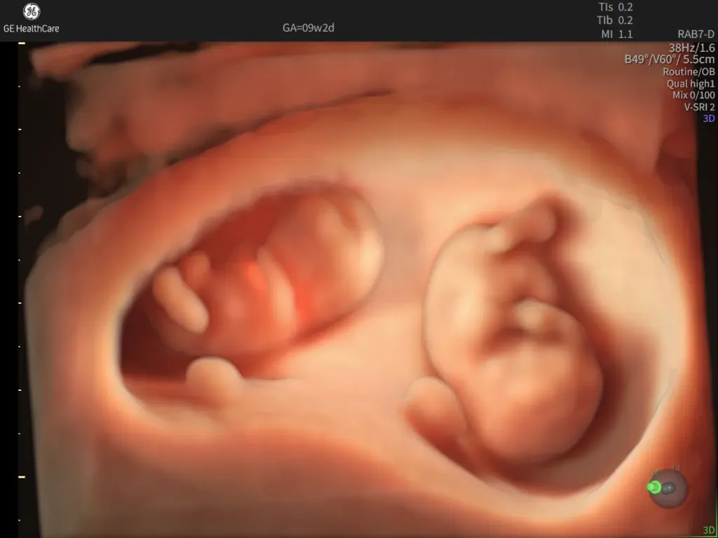 9 week twins with HDlive