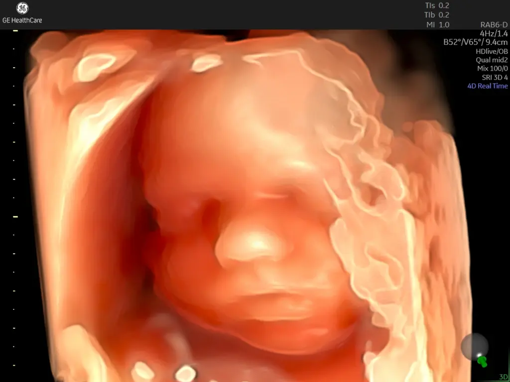 30-week fetal face