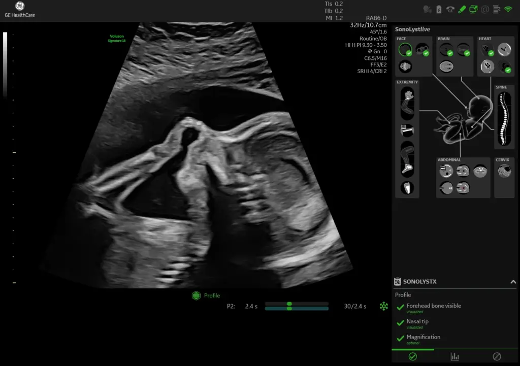 Fetal profile