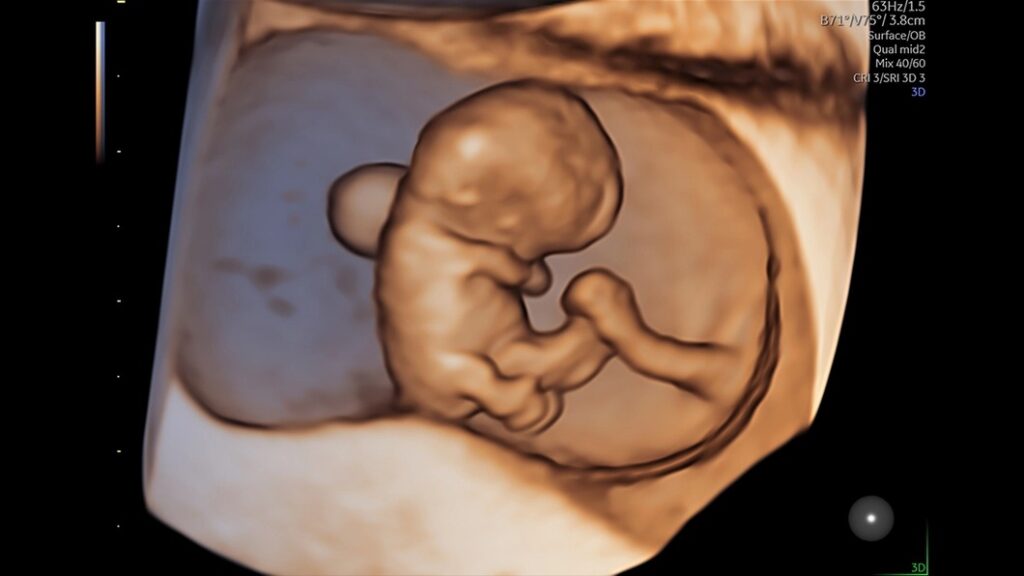 9 Week Fetus