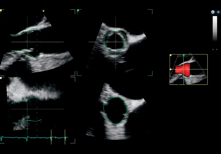 4D Auto AVQ