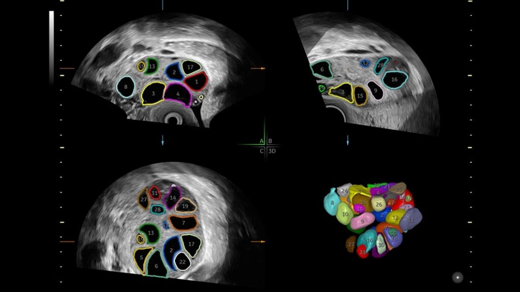 3D Ovary