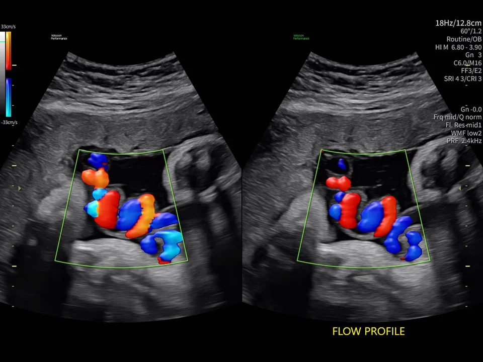 Image Capabilities Features