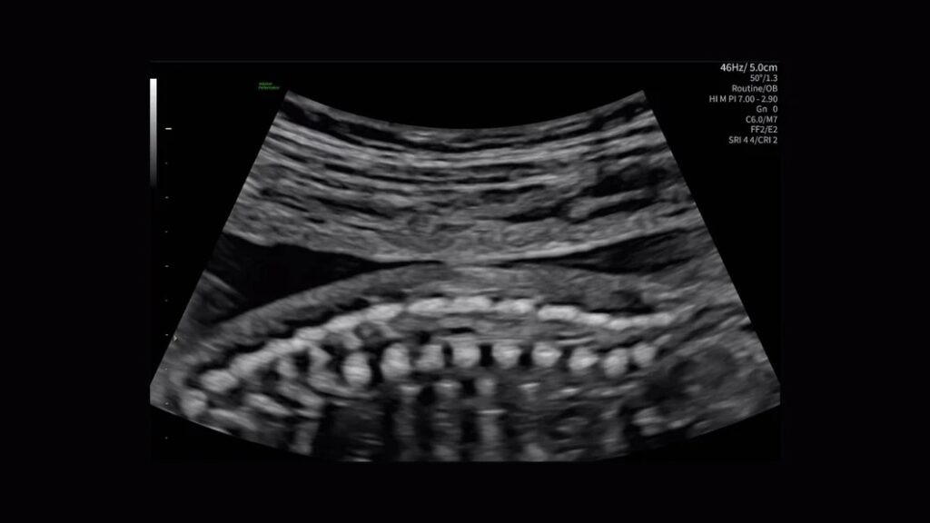 28 Week Spine