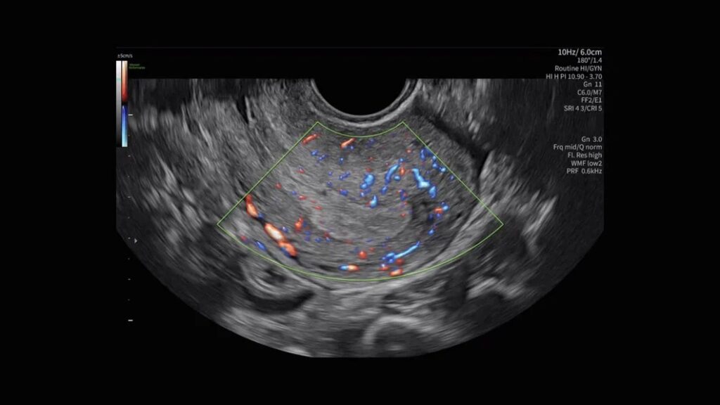 Pelvic Health Radiant Flow Uterus