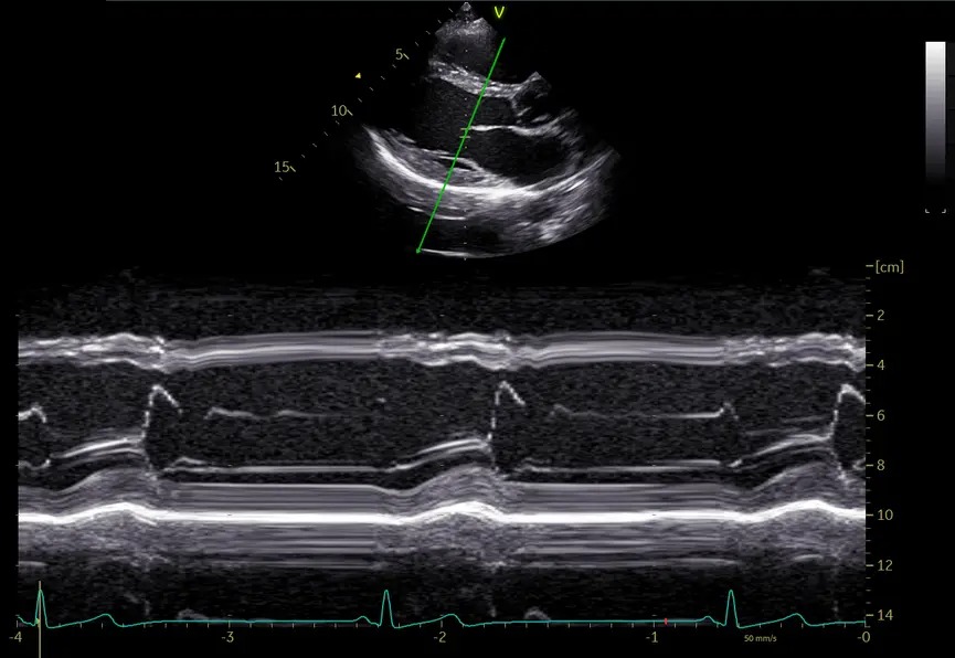 Live Anatomical M-Mode