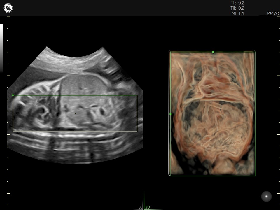 RM7C OB 3D HD Live Studio Chest Abdomen
