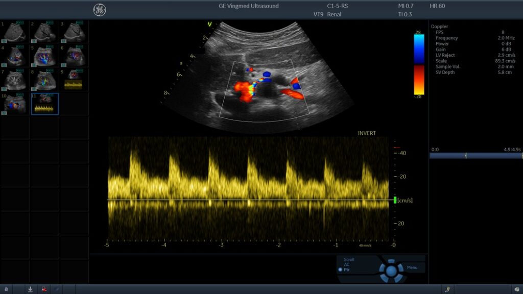 Abdomen Clinical