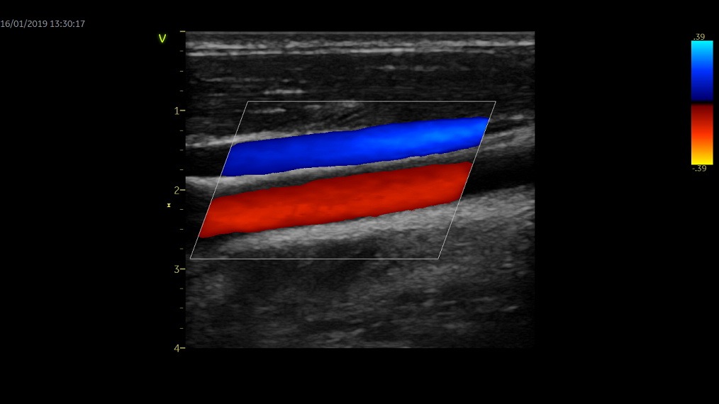 Vascular Clinical