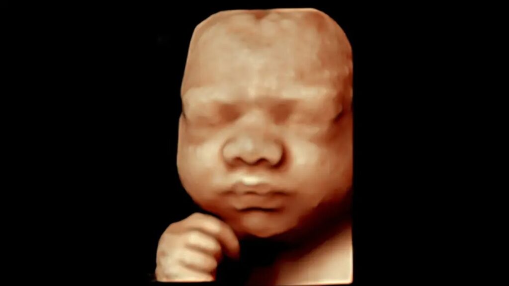 Fetal Face