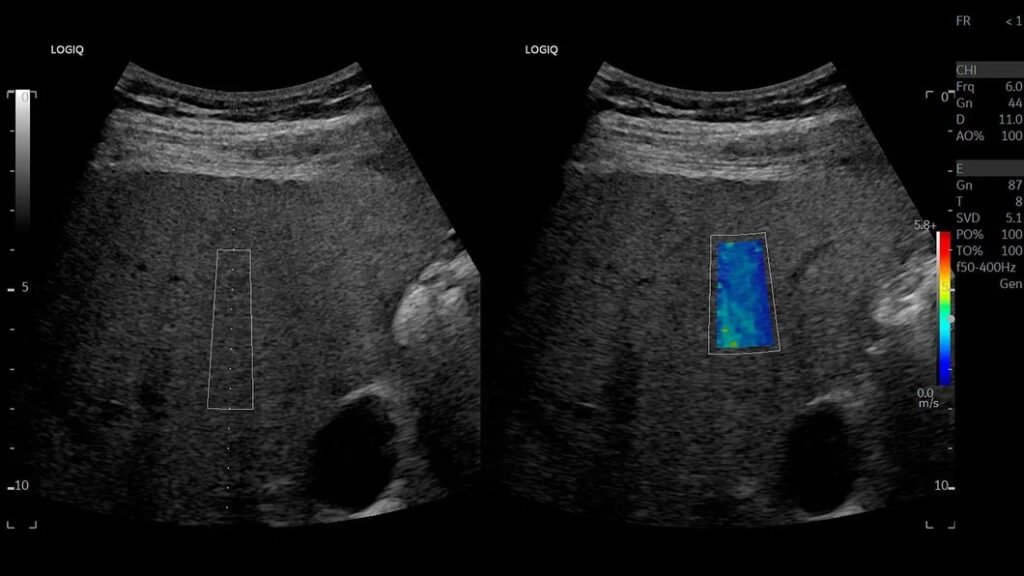 Hepatic Assistant, C1-6-D