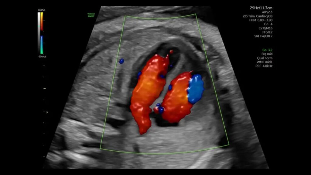 Radiant Flow 26 Week