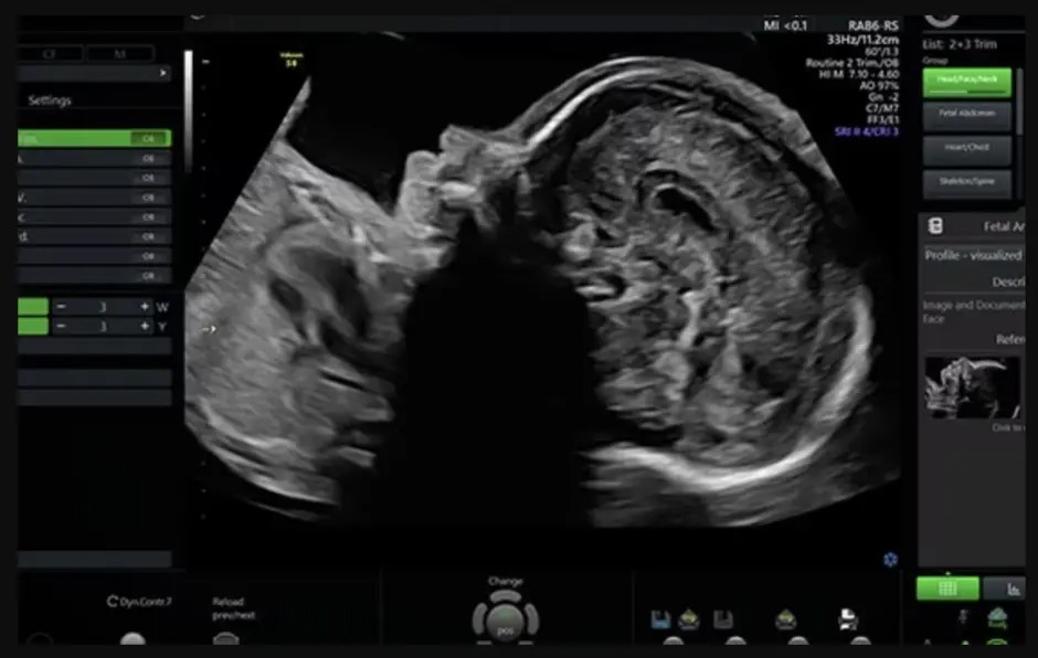 Scan Assist