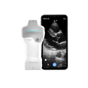 Vscan Air SL