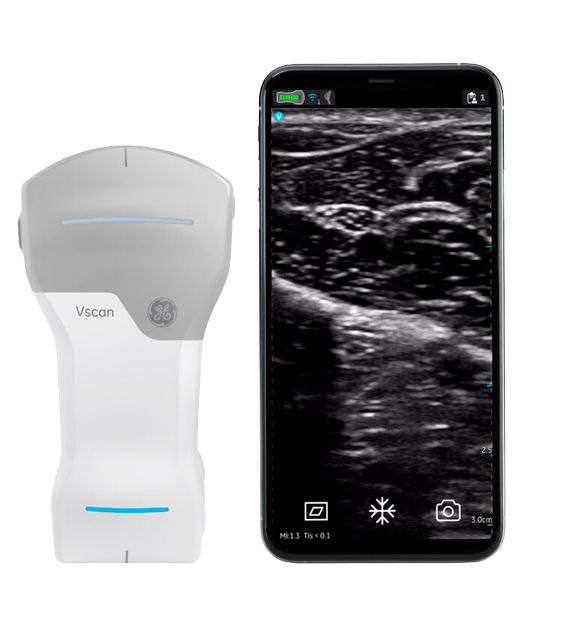 Vscan Air CL