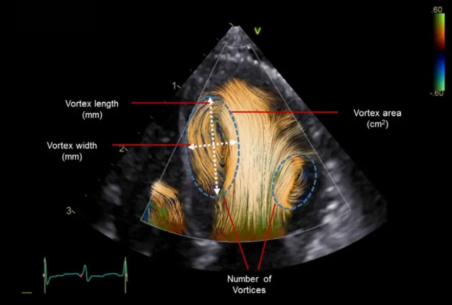 Blood Speckle Imaging
