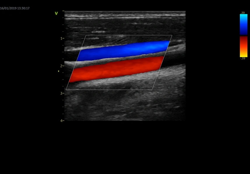 Vascular Clinical Scene